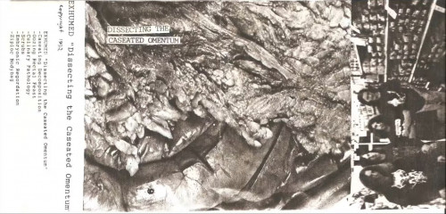 Exhumed - Dissecting the Caseated Omentum cover art