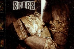 Scars photo