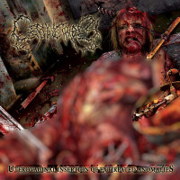 Uterovaginal Insertion of Extirpated Anomalies